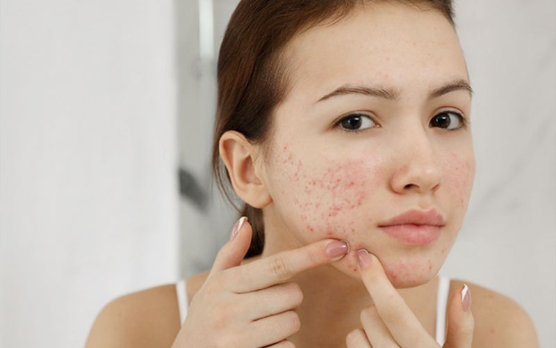 Nên hạn chế để tay chạm da mặt nếu không muốn bụi bẩn và vi khuẩn bám lấy da.
